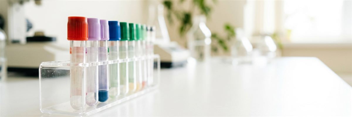 Gradilla con tubos de recolecci&oacute;n de muestras sobre mesa de laboratorio